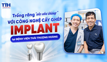 Trồng răng “nhẹ như không” với công nghệ cấy ghép Implant