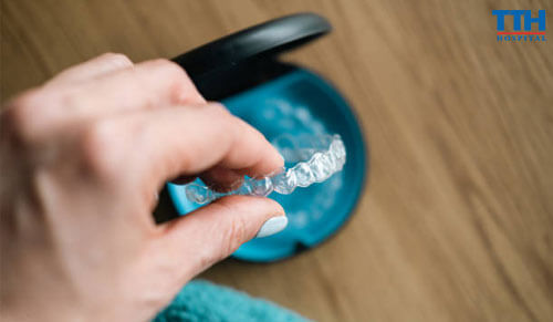 Vật Liệu SmartTrack: Cách Mạng Trong Niềng Răng Invisalign