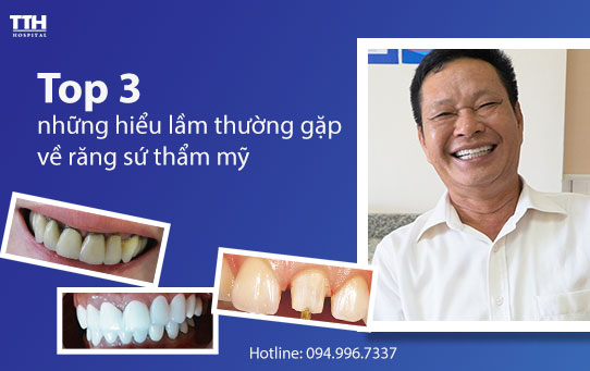 Top 3 những hiểu lầm thường gặp về răng sứ thẩm mỹ
