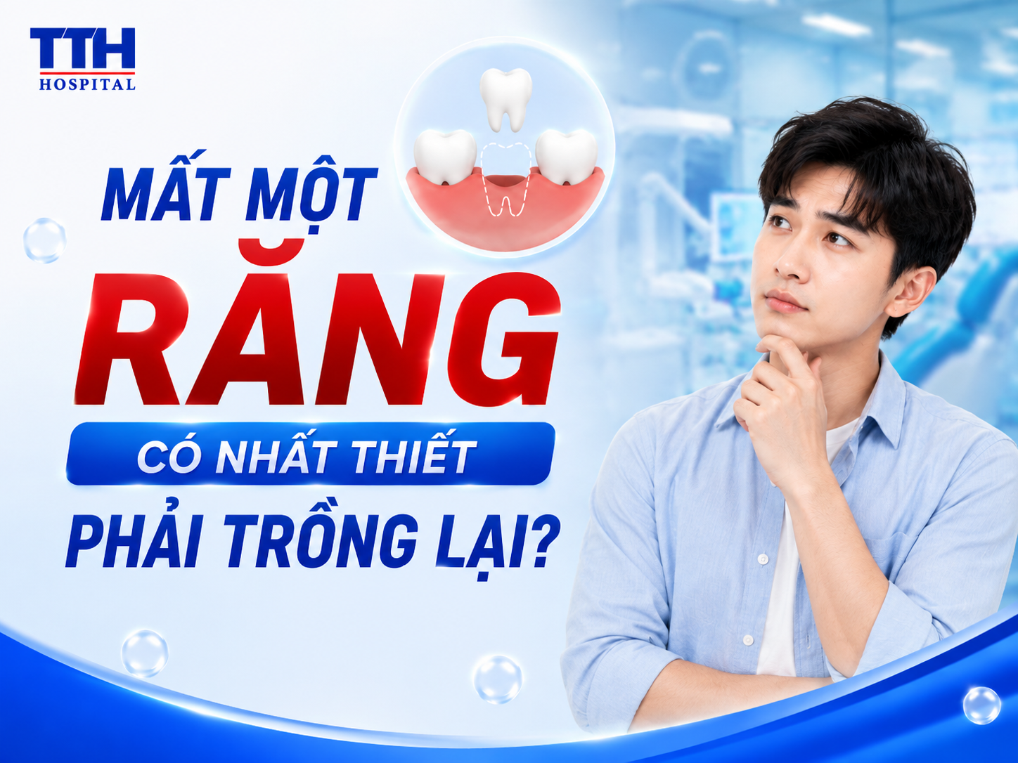 MẤT MỘT RĂNG CÓ NHẤT THIẾT PHẢI TRỒNG LẠI?