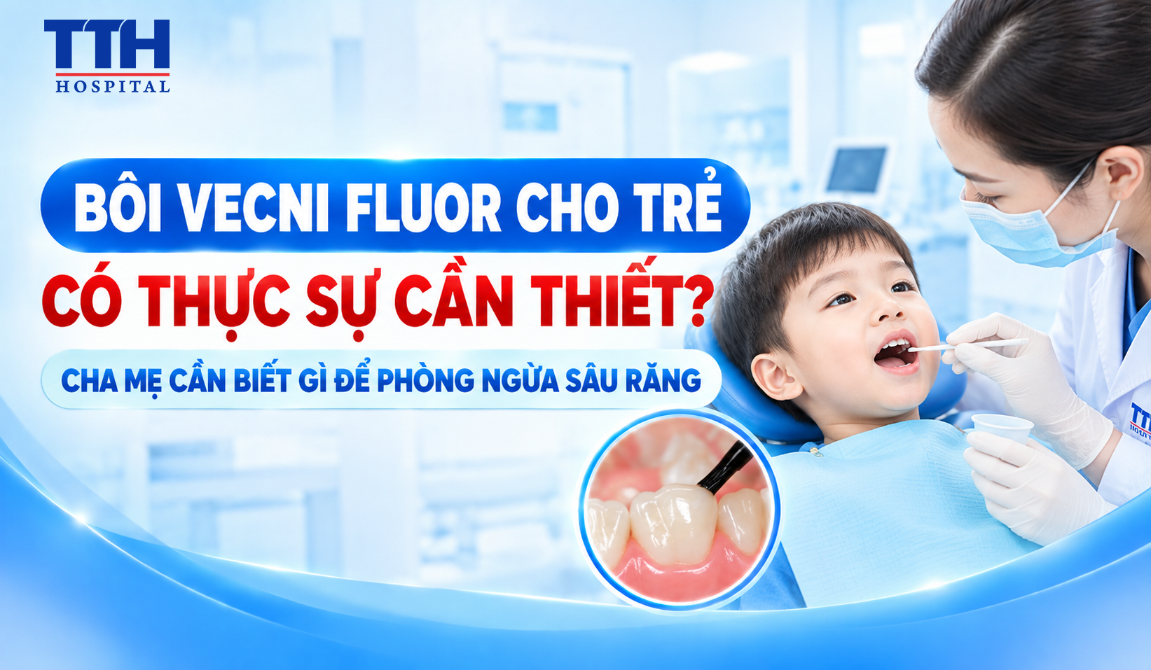 BÔI VECNI FLUOR CHO TRẺ CÓ THỰC SỰ CẦN THIẾT? CHA MẸ CẦN BIẾT GÌ ĐỂ PHÒNG NGỪA SÂU RĂNG