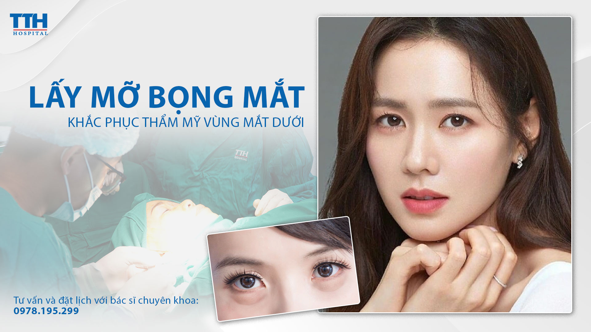 Lấy bọng mắt, khắc phục nếp nhăn vùng mắt dưới hiệu quả. Bệnh viện Thái Thượng Hoàng - Địa chỉ cắt mí mắt dưới uy tín Nghệ An, Hà Tĩnh