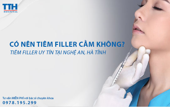 Có nên tiêm filler cằm không? Tiêm Filler uy tín tại Nghệ An, Hà Tĩnh