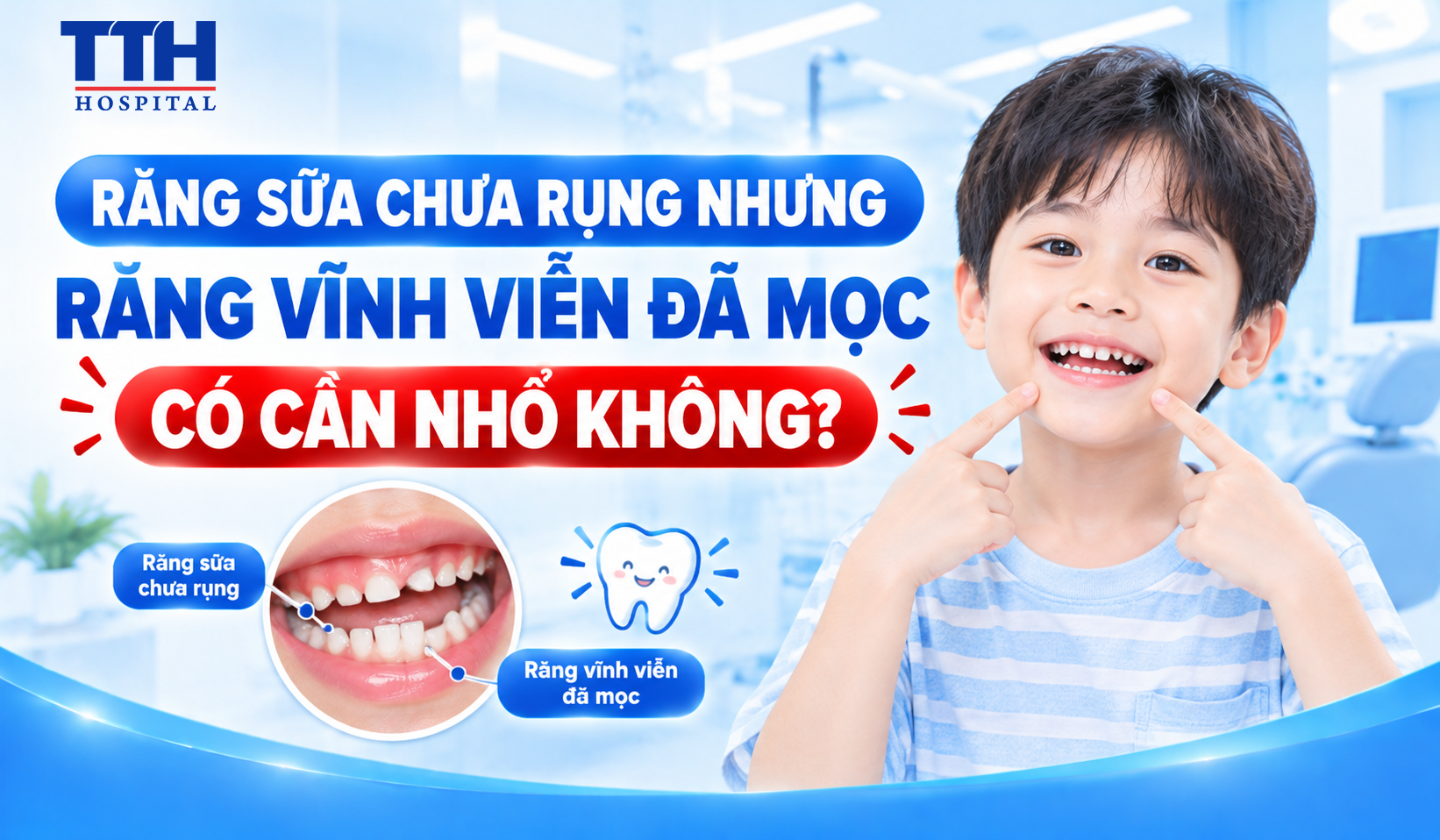 RĂNG SỮA CHƯA RỤNG NHƯNG RĂNG VĨNH VIỄN ĐÃ MỌC: CÓ CẦN NHỔ KHÔNG?