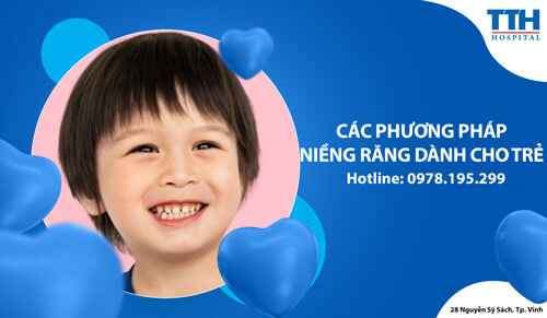 Răng hô và cách khắc phục hiệu quả