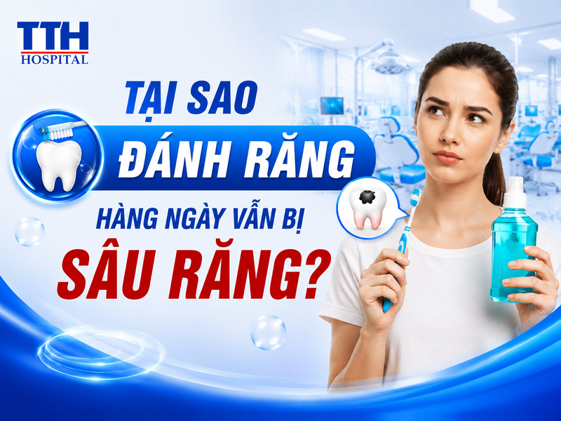 TẠI SAO ĐÁNH RĂNG HÀNG NGÀY VẪN BỊ SÂU RĂNG?