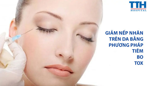 GIẢM NẾP NHĂN TRÊN DA BẰNG PHƯƠNG PHÁP TIÊM BO TOX