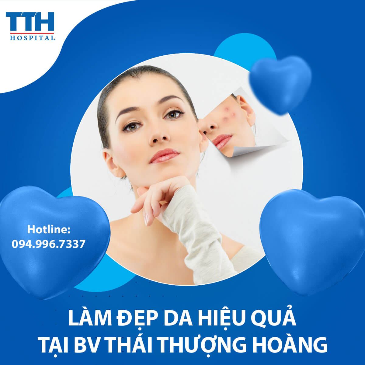 Làm Đẹp Da Tại Vinh - Mẹo chăm sóc da tại nhà