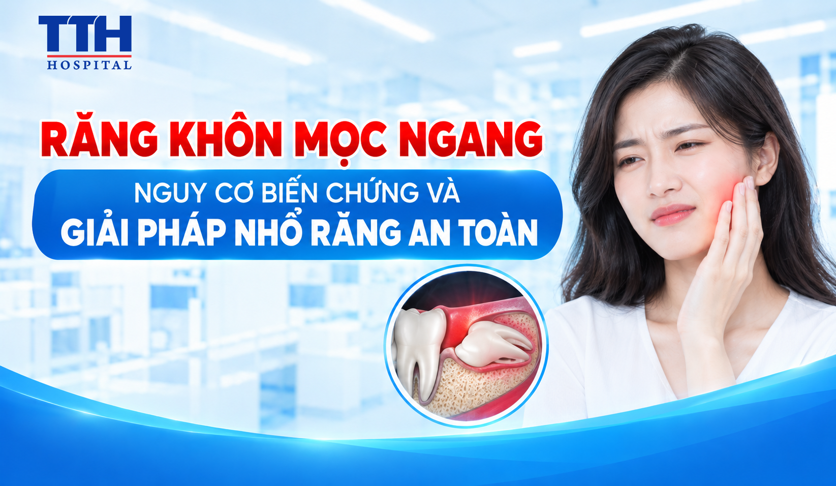 RĂNG KHÔN MỌC NGANG: NGUY CƠ BIẾN CHỨNG VÀ GIẢI PHÁP NHỔ RĂNG AN TOÀN