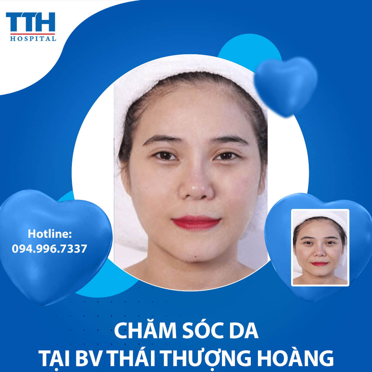 Xác định loại da mặt của bạn và cách chăm sóc hiệu quả