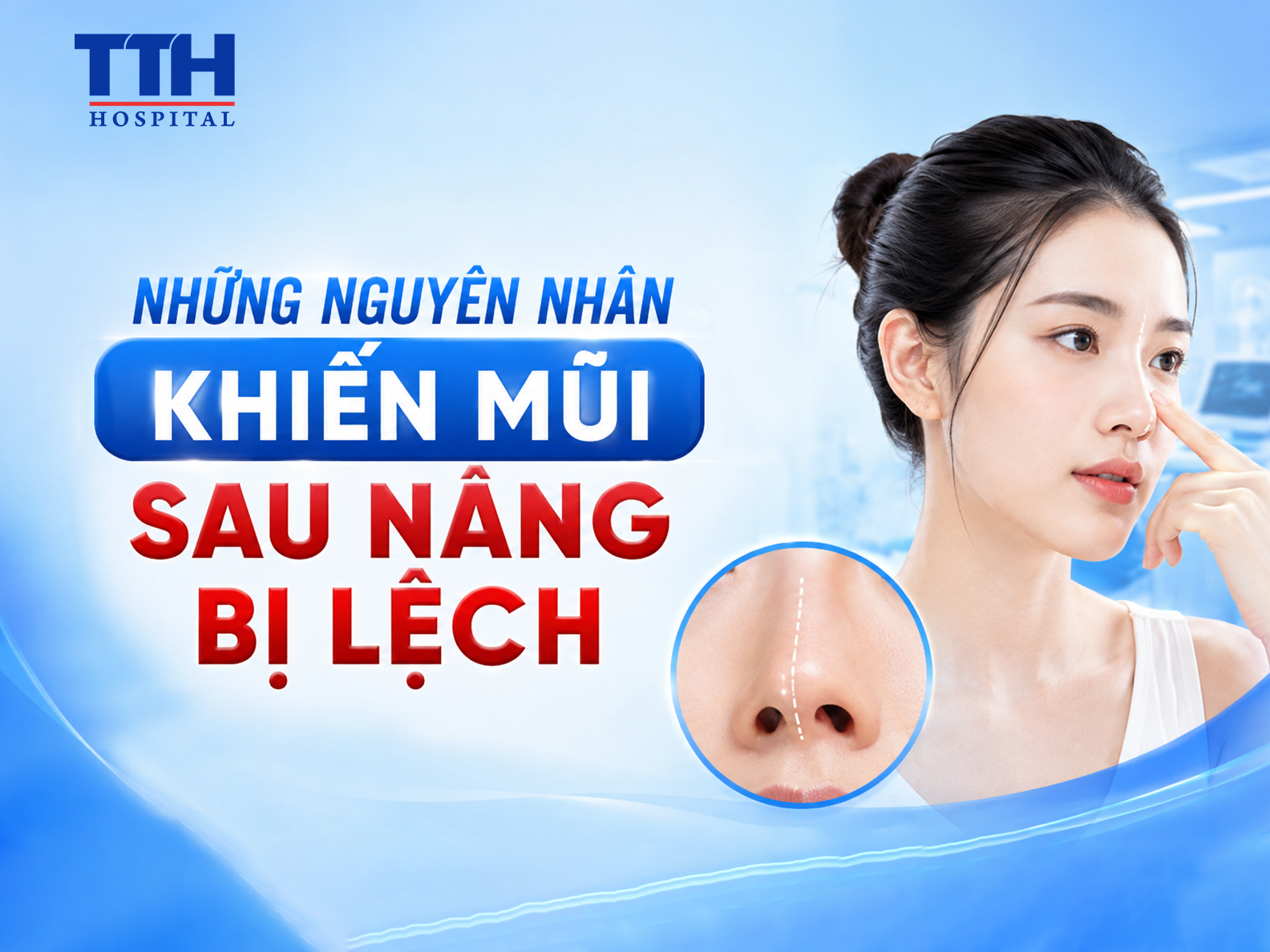 NHỮNG NGUYÊN NHÂN KHIẾN MŨI SAU NÂNG BỊ LỆCH