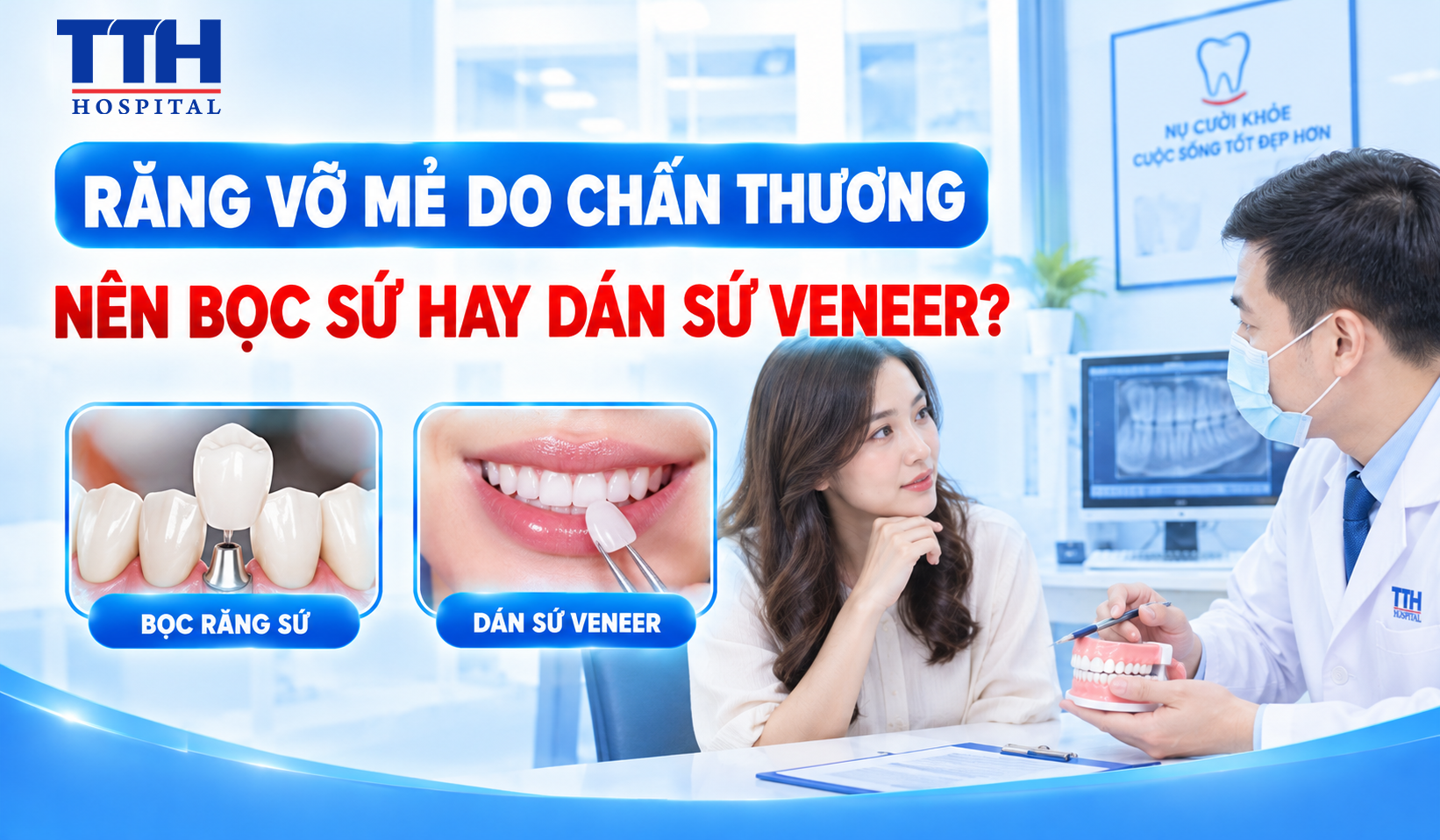 RĂNG VỠ MẺ DO CHẤN THƯƠNG NÊN BỌC SỨ HAY DÁN SỨ VENEER?