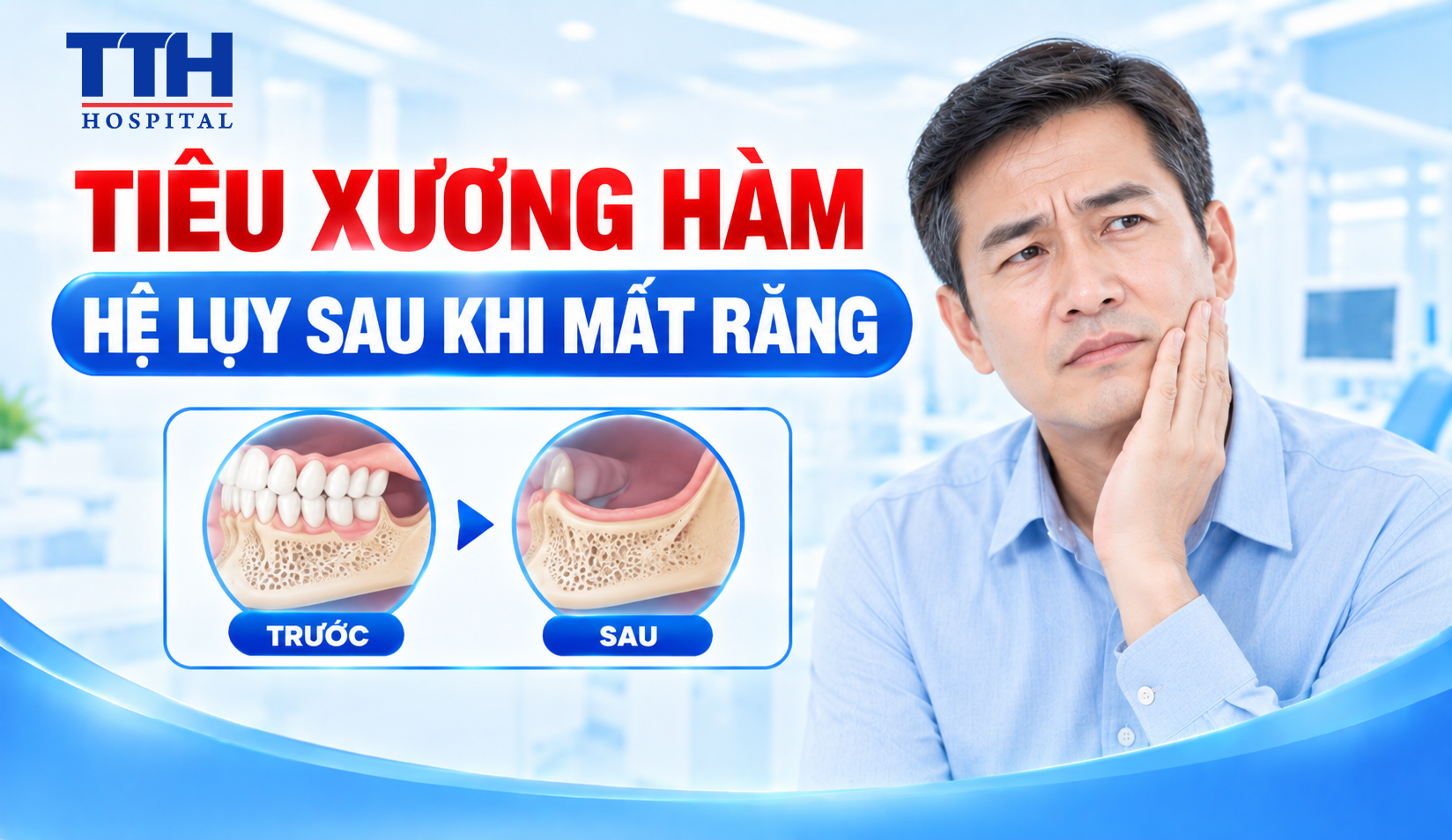 TIÊU XƯƠNG HÀM – HỆ LỤY SAU KHI MẤT RĂNG