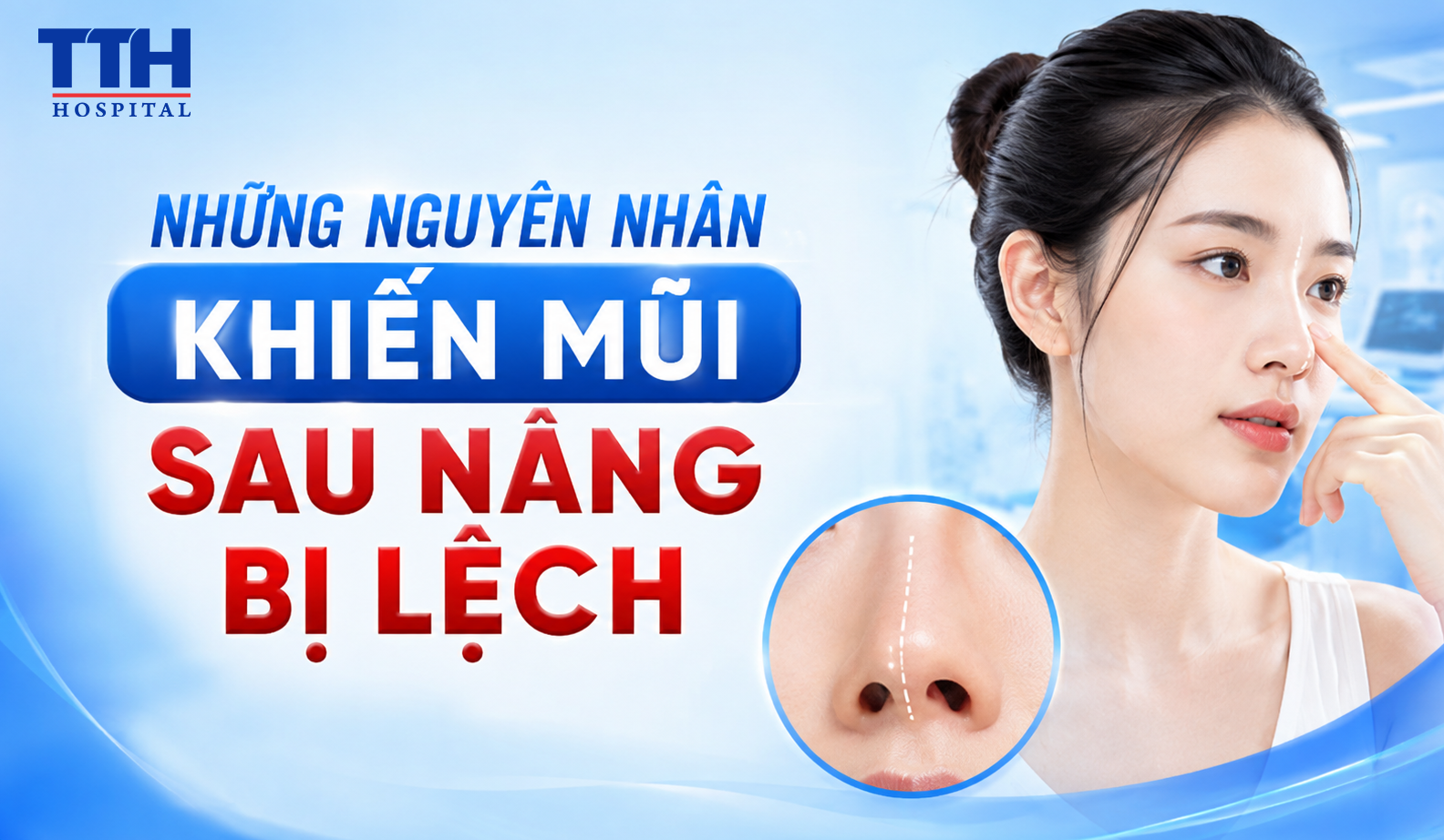 NHỮNG NGUYÊN NHÂN KHIẾN MŨI SAU NÂNG BỊ LỆCH