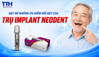 BẬT MÍ NHỮNG ƯU ĐIỂM NỔI BẬT CỦA IMPLANT NEODENT