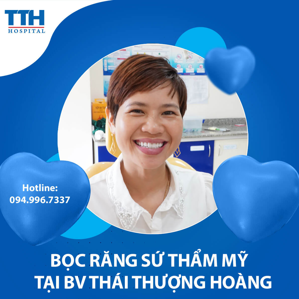 Bọc răng sứ và những điều cần biết