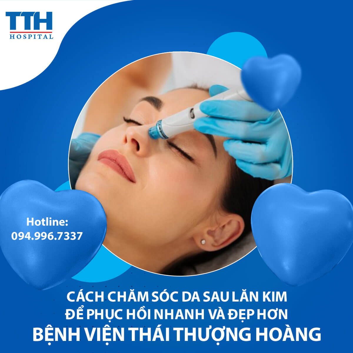 Cách chăm sóc da sau lăn kim để phục hồi nhanh và đẹp hơn
