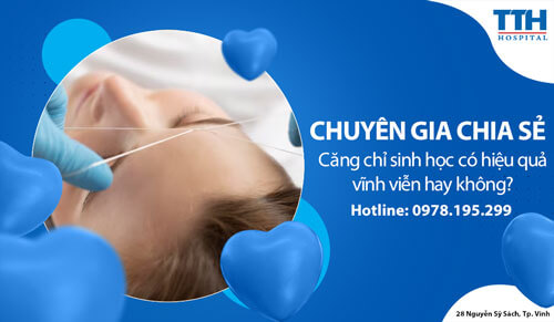 Căng chỉ sinh học có hiệu quả vĩnh viễn hay không?