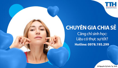 Căng chỉ sinh học: Liệu có thực sự tốt?