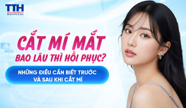 CẮT MÍ MẮT BAO LÂU THÌ HỒI PHỤC?