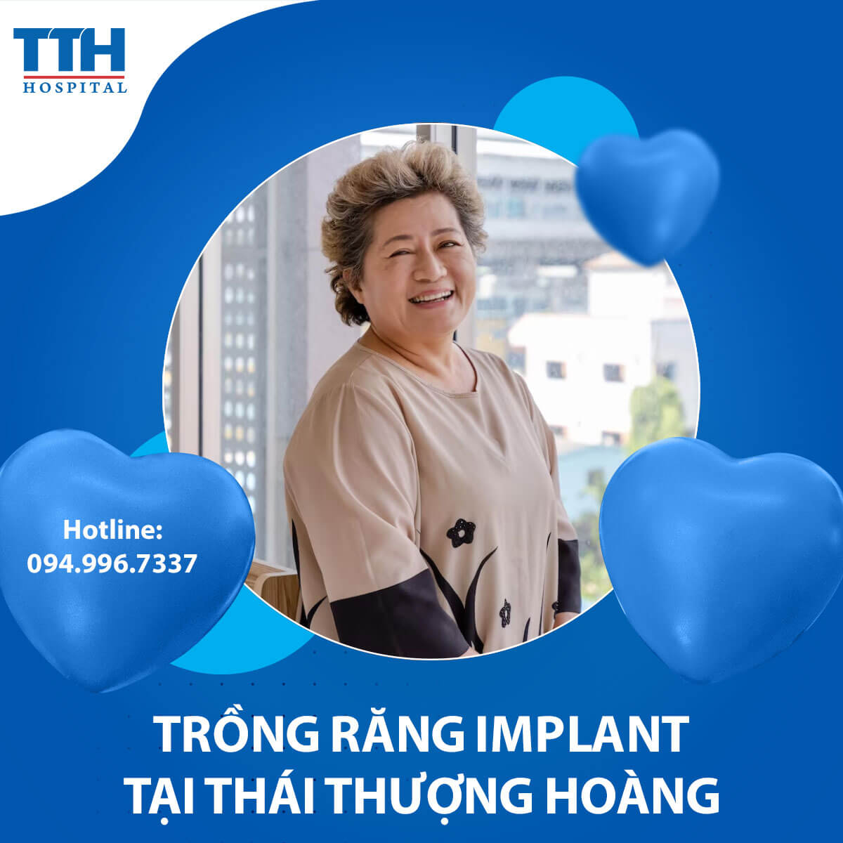 Cấu tạo Trụ Implant và Các Loại Trụ Implant Phổ Biến Năm 2023