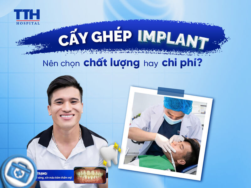 CẤY GHÉP IMPLANT – NÊN CHỌN CHẤT LƯỢNG HAY CHI PHÍ?