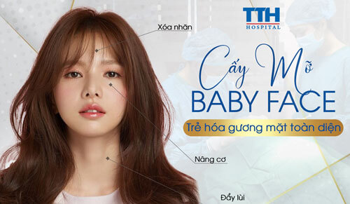 Cấy mỡ Baby Face – Bí quyết trẻ hóa toàn diện cho gương mặt