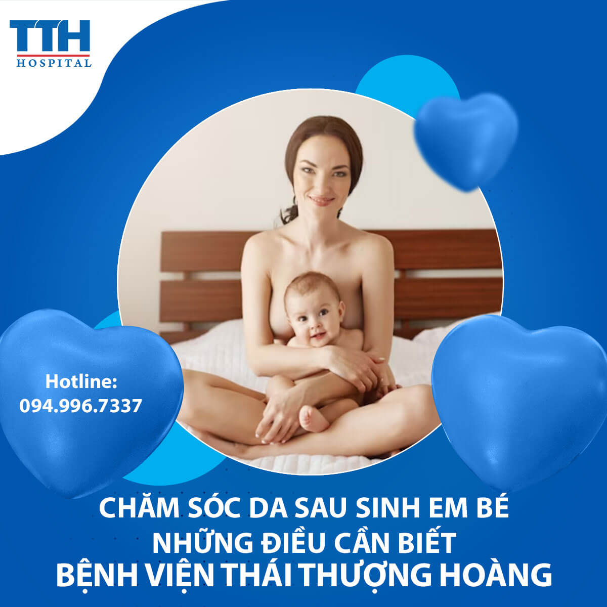 Chăm sóc da sau sinh em bé - Những điều cần biết