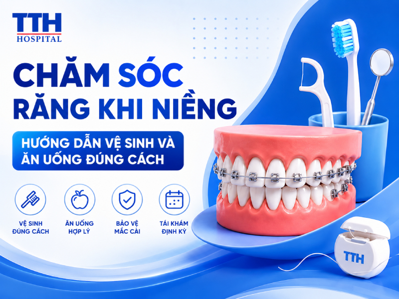 CHĂM SÓC RĂNG KHI NIỀNG: HƯỚNG DẪN VỆ SINH VÀ ĂN UỐNG ĐÚNG CÁCH
