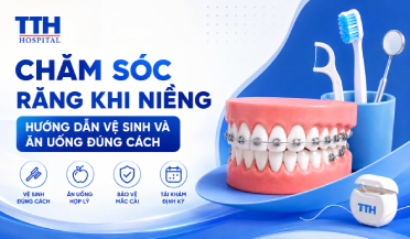 CHĂM SÓC RĂNG KHI NIỀNG: HƯỚNG DẪN VỆ SINH VÀ ĂN UỐNG ĐÚNG CÁCH