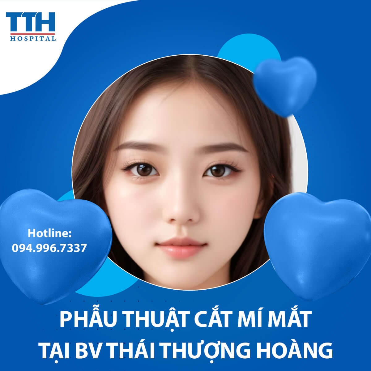 Chia Sẻ Kinh Nghiệm Chăm Sóc Sau Phẫu Thuật Cắt Mí Mắt