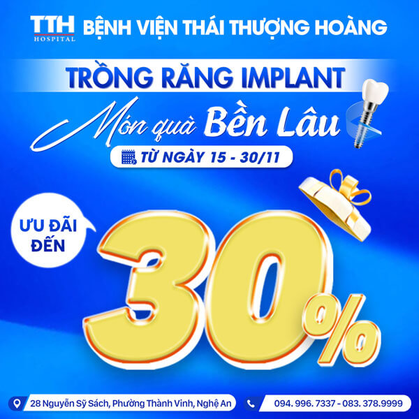 Chương trình ưu đãi implant tháng 11 của bệnh viện Thái Thượng Hoàng