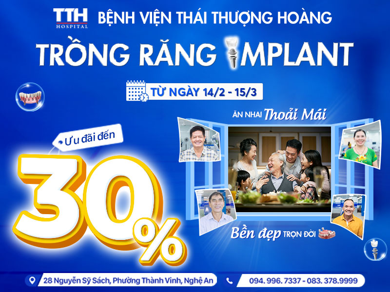 CHƯƠNG TRÌNH ƯU ĐÃI TRỒNG RĂNG IMPLANT