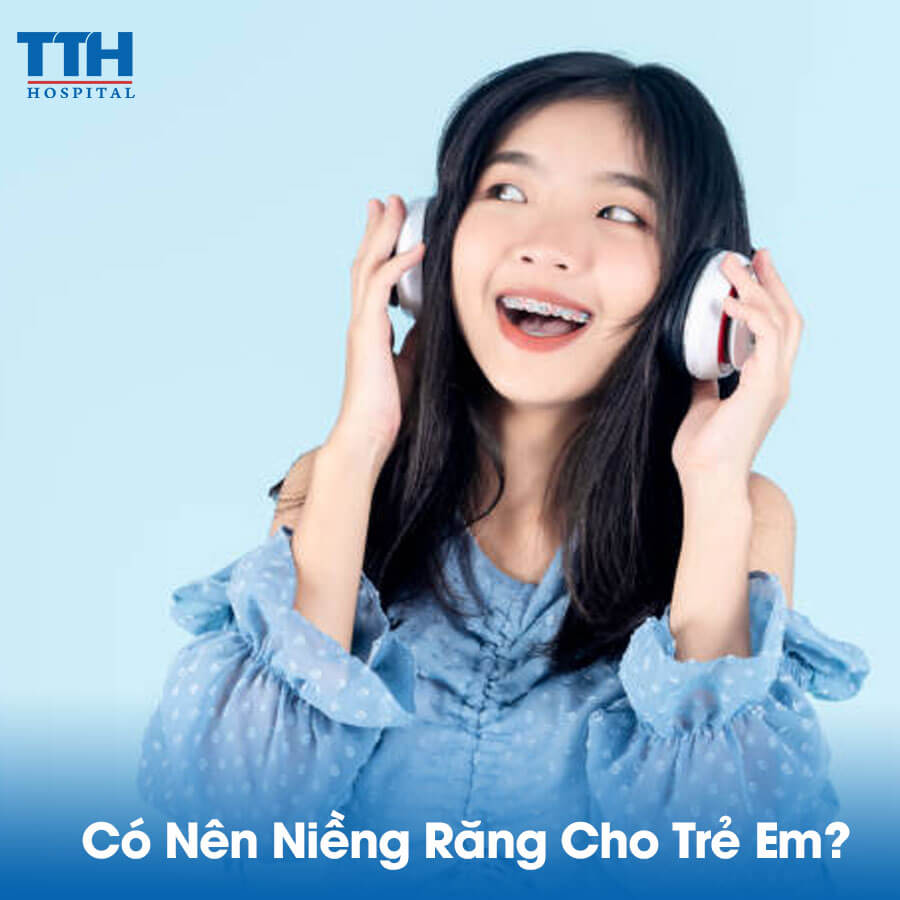 Có Nên Niềng Răng Cho Trẻ Em?