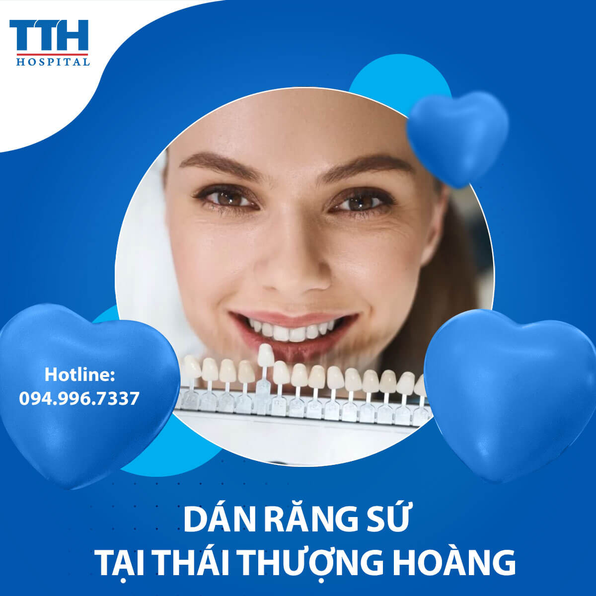 Dán Răng Sứ Smart Veneer