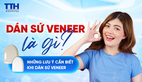 Dán sứ veneer là gì và những lưu ý cần biết khi dán sứ veneer