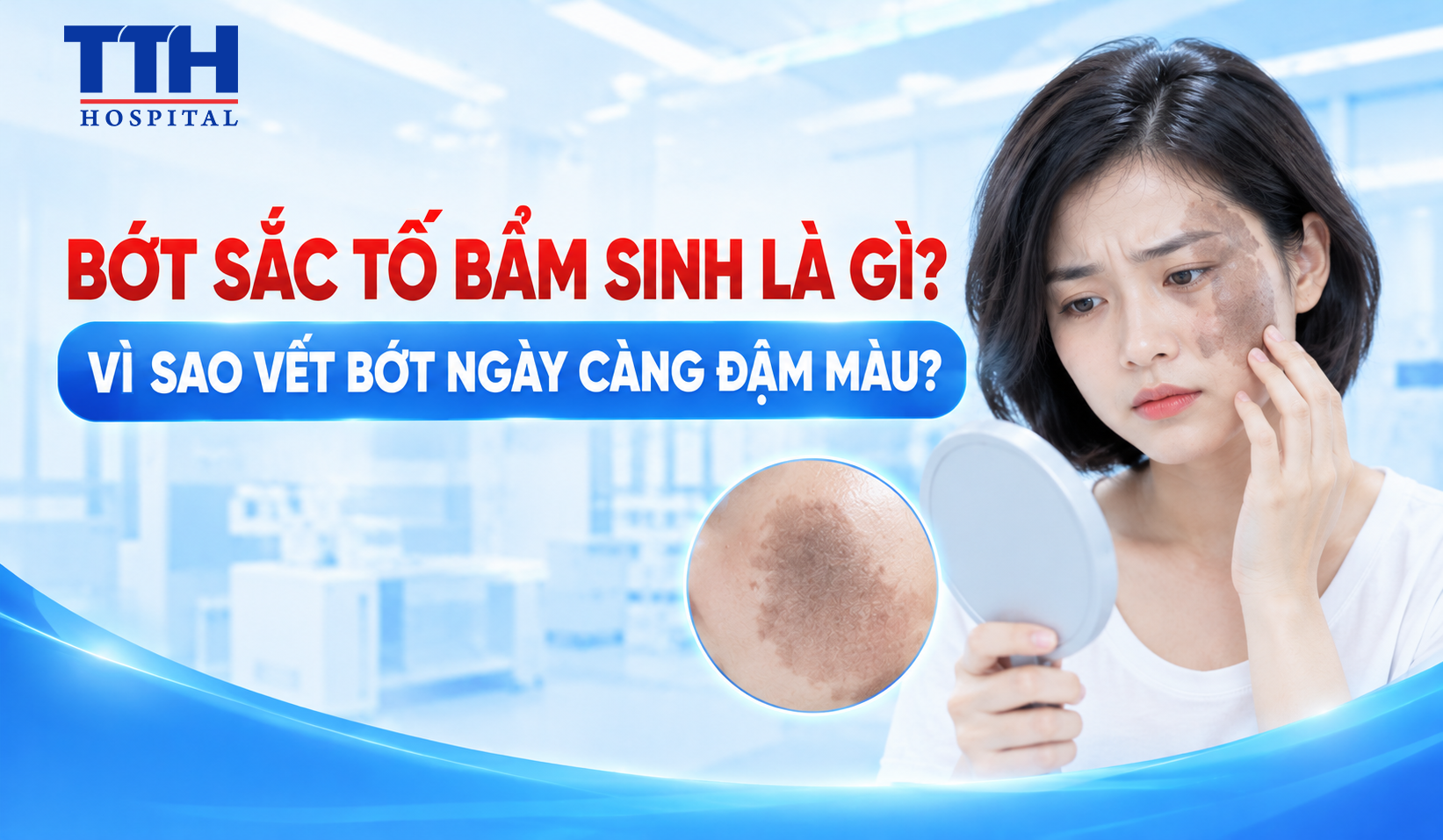 BỚT SẮC TỐ BẨM SINH LÀ GÌ? VÌ SAO VẾT BỚT NGÀY CÀNG ĐẬM MÀU?