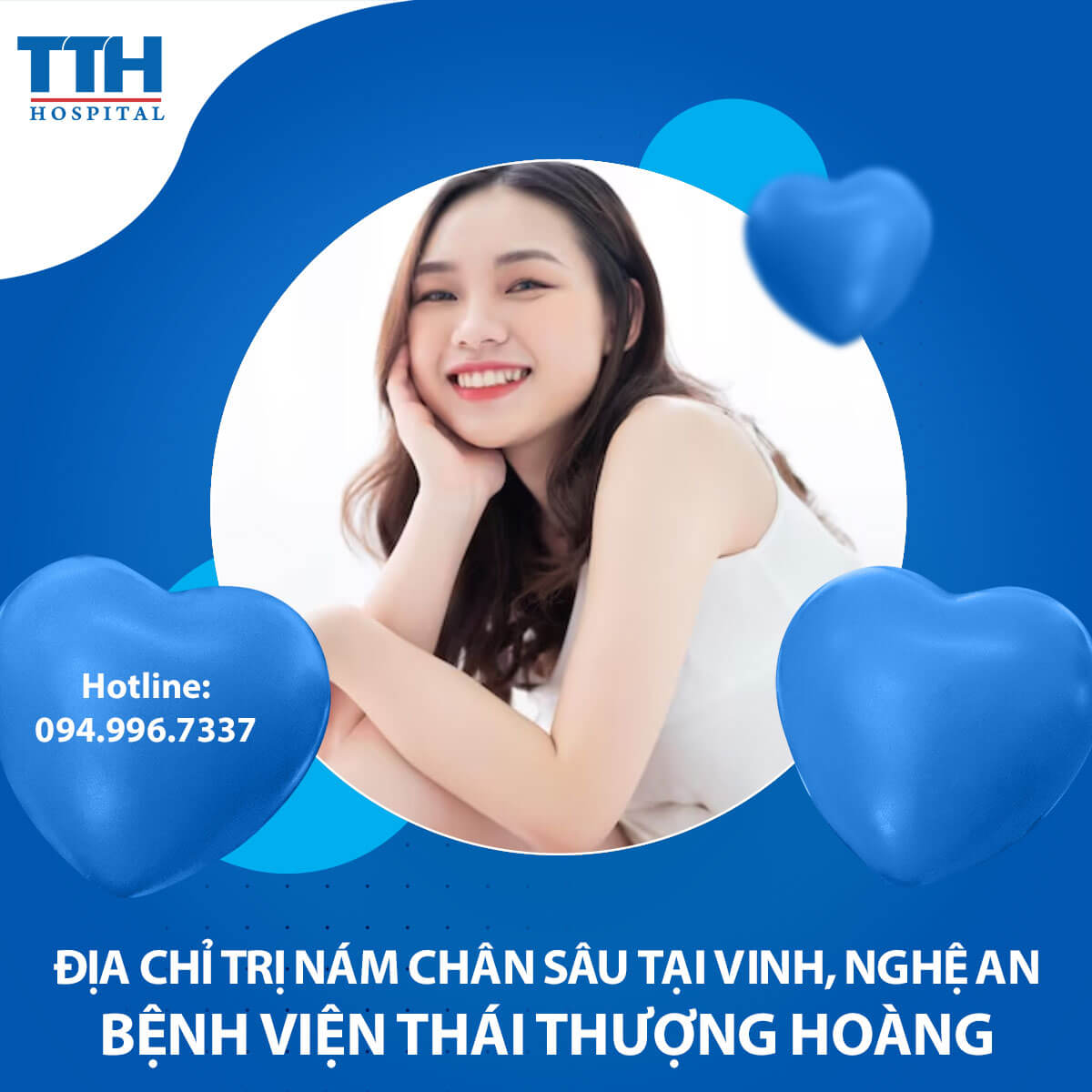 Địa chỉ trị nám chân sâu tại Vinh, Nghệ An: Phương pháp hiệu quả từ chuyên gia