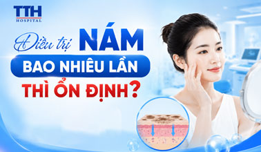 ĐIỀU TRỊ NÁM BAO NHIÊU LẦN THÌ ỔN ĐỊNH?