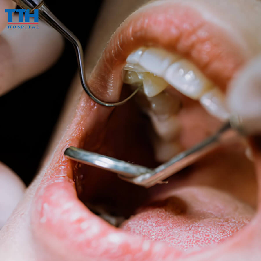 Điều Trị Tủy Có Đau Không?