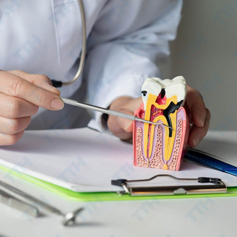 Điều Trị Tủy Răng Có Được Bảo Hiểm Y Tế Không?