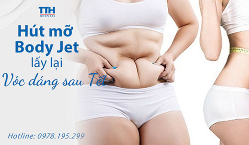 Lấy lại vóc dáng sau Tết với hút mỡ Body Jet