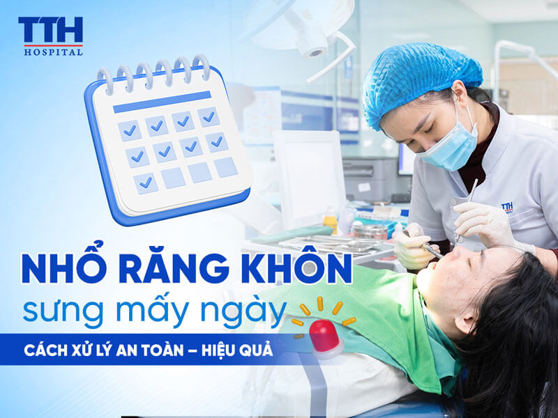 NHỔ RĂNG KHÔN SƯNG MẤY NGÀY?