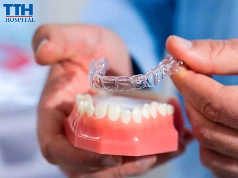 Những trường hợp nên niềng răng trong suốt
