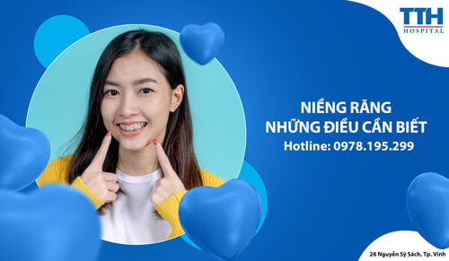 Niềng răng - Những điều cần biết