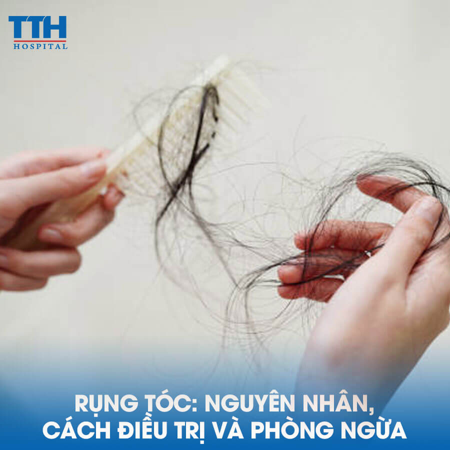 Rụng Tóc: Nguyên Nhân, Cách Điều Trị và Phòng Ngừa