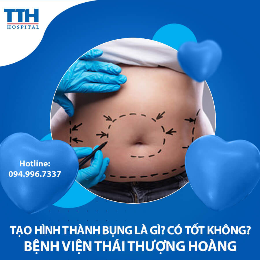 Tạo hình thành bụng là gì? Có tốt không?