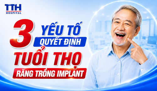 3 YẾU TỐ QUYẾT ĐỊNH TUỔI THỌ RĂNG TRỒNG IMPLANT