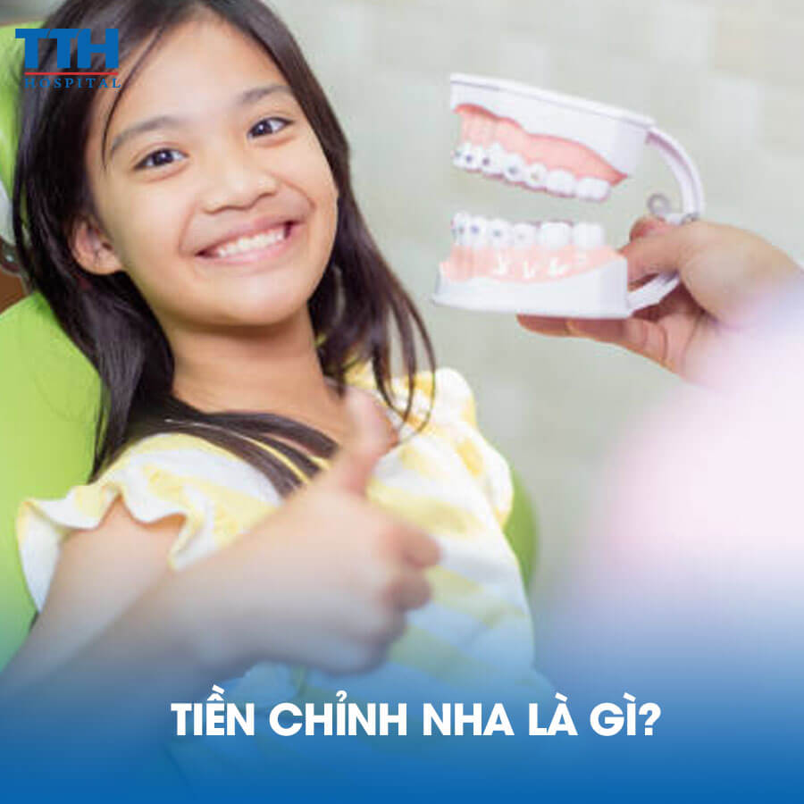 Tiền Chỉnh Nha Là Gì?