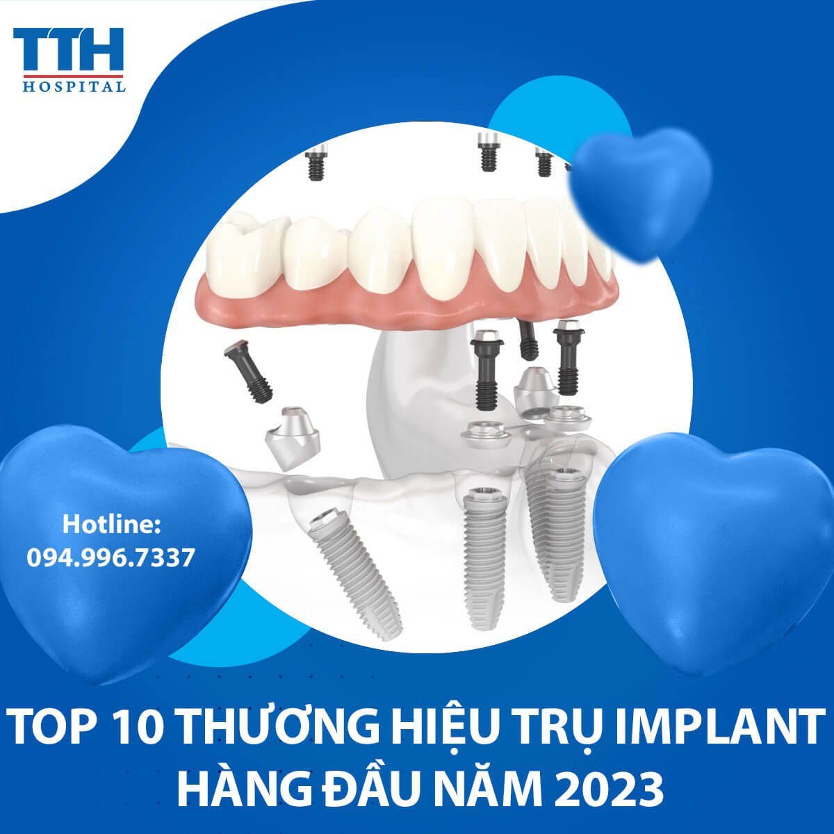 Top 10 thương hiệu Trụ Implant  năm 2023